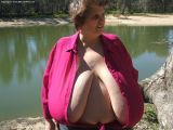 massive breast