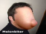 Melonbiter